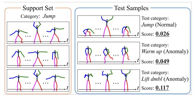Few-shot human action anomaly detection teaser